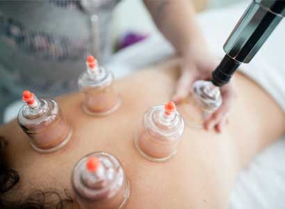 Blood Circulation with Cupping Therapy