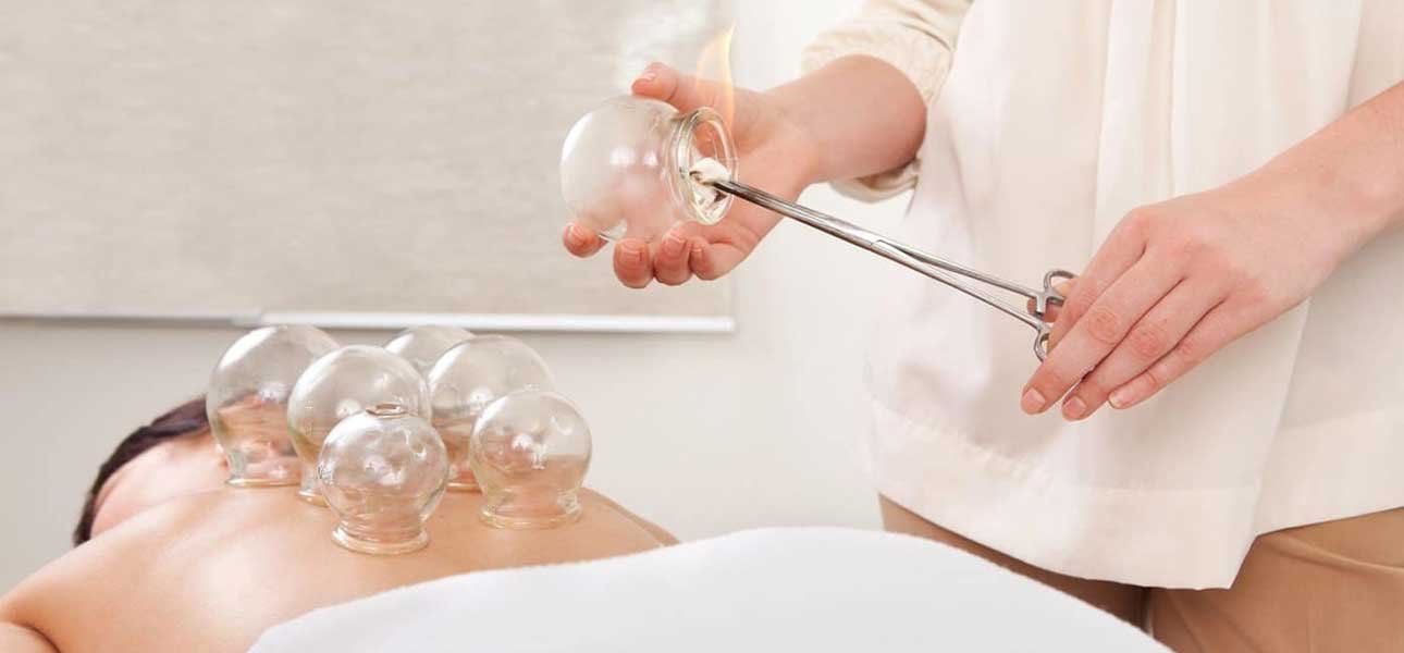 Cupping Therapy Treatment